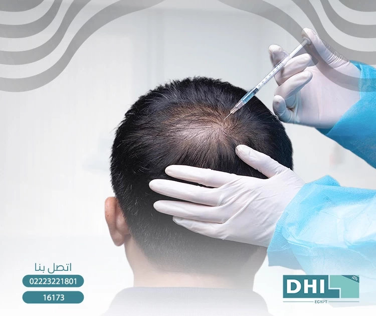 عيادات مصر التخصصية لزراعة الشعر
