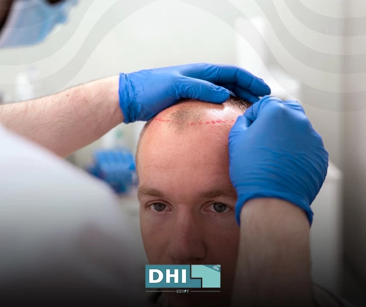 hair transplant technician