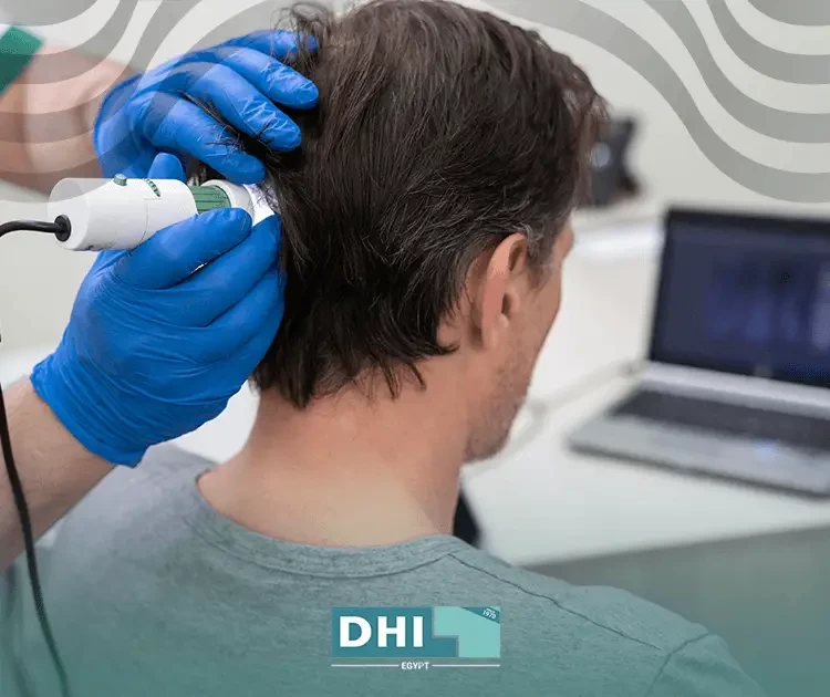 DHI hair transplant Egypt
