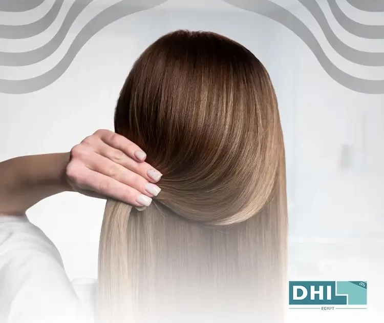 كيفية زرع الشعر للنساء