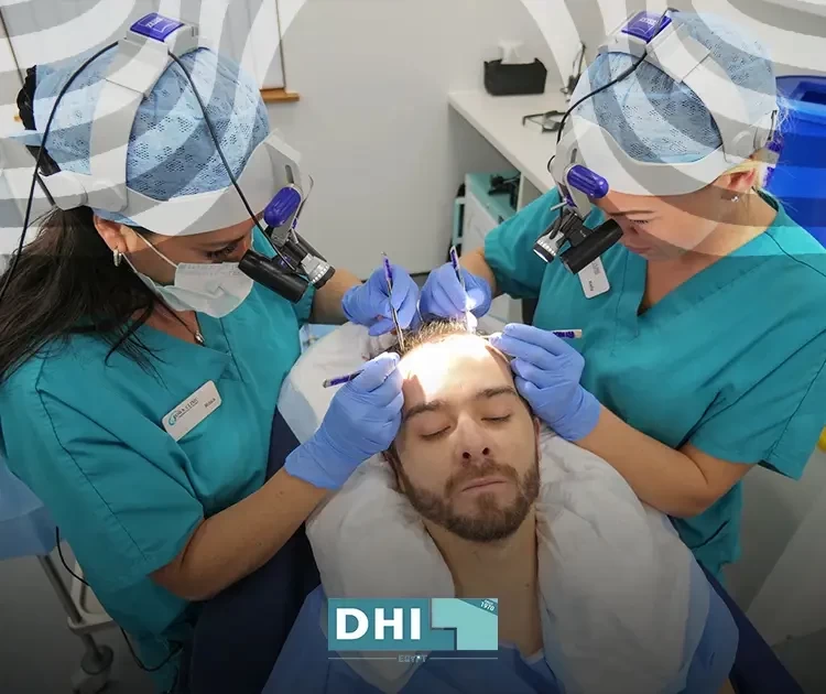قبل التفكير في زراعة الشعر