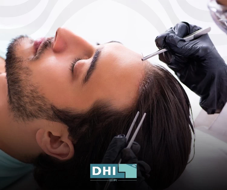 hair transplant surgery results