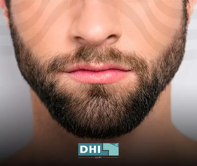 زراعة شعر اللحية
