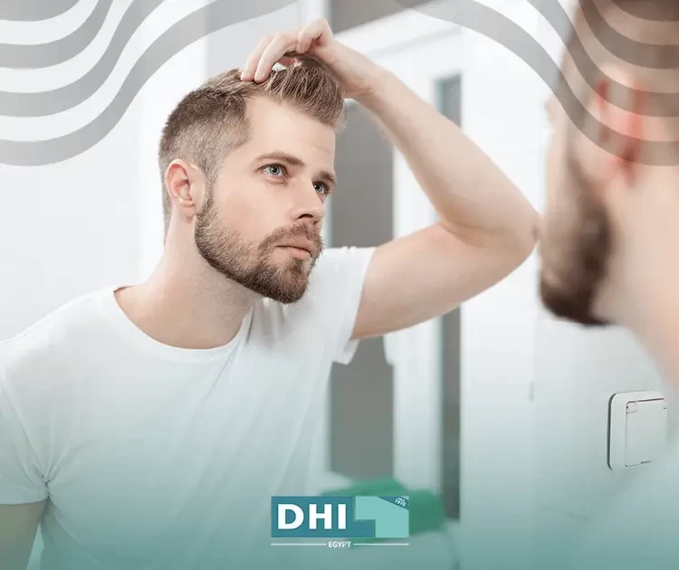 Can transplanted hair fall