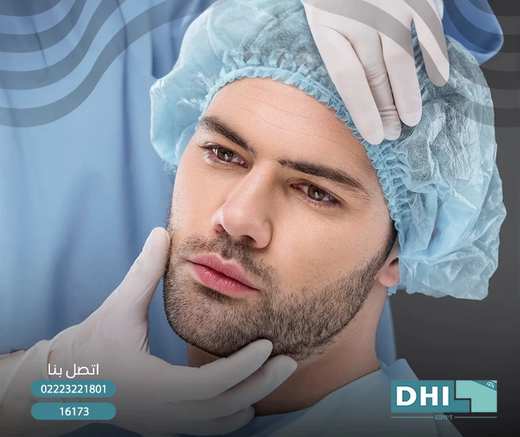 زراعة شعر اللحية